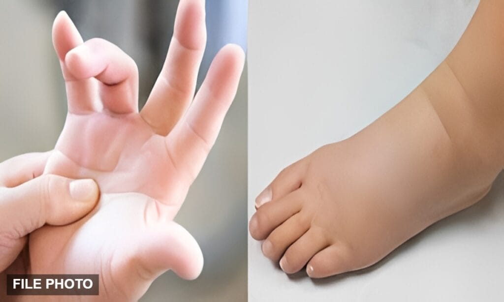 سوجن کو معمولی نہ سمجھیں، یہ سنگین بیماری کی خاموش علامت ہو سکتی ہے۔ 1 سوجن کو معمولی نہ سمجھیں، یہ سنگین بیماری کی خاموش علامت ہو سکتی ہے۔