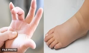 سوجن کو معمولی نہ سمجھیں، یہ سنگین بیماری کی خاموش علامت ہو سکتی ہے۔