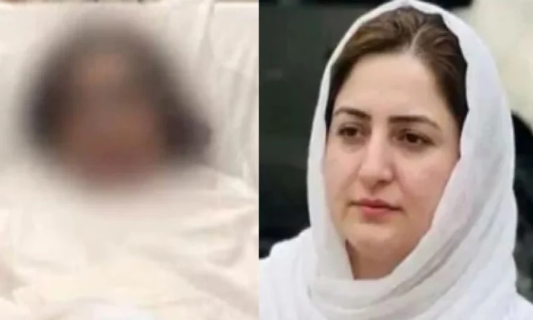 تیزاب گردی کا شکارلیڈی ڈاکٹر ماہ نور کے علاج کیلئے امریکا منتقلی کا فیصلہ