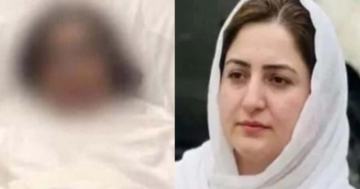 تیزاب گردی کا شکارلیڈی ڈاکٹر ماہ نور کے علاج کیلئے امریکا منتقلی کا فیصلہ
